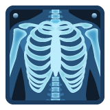 X-ray on WhatsApp